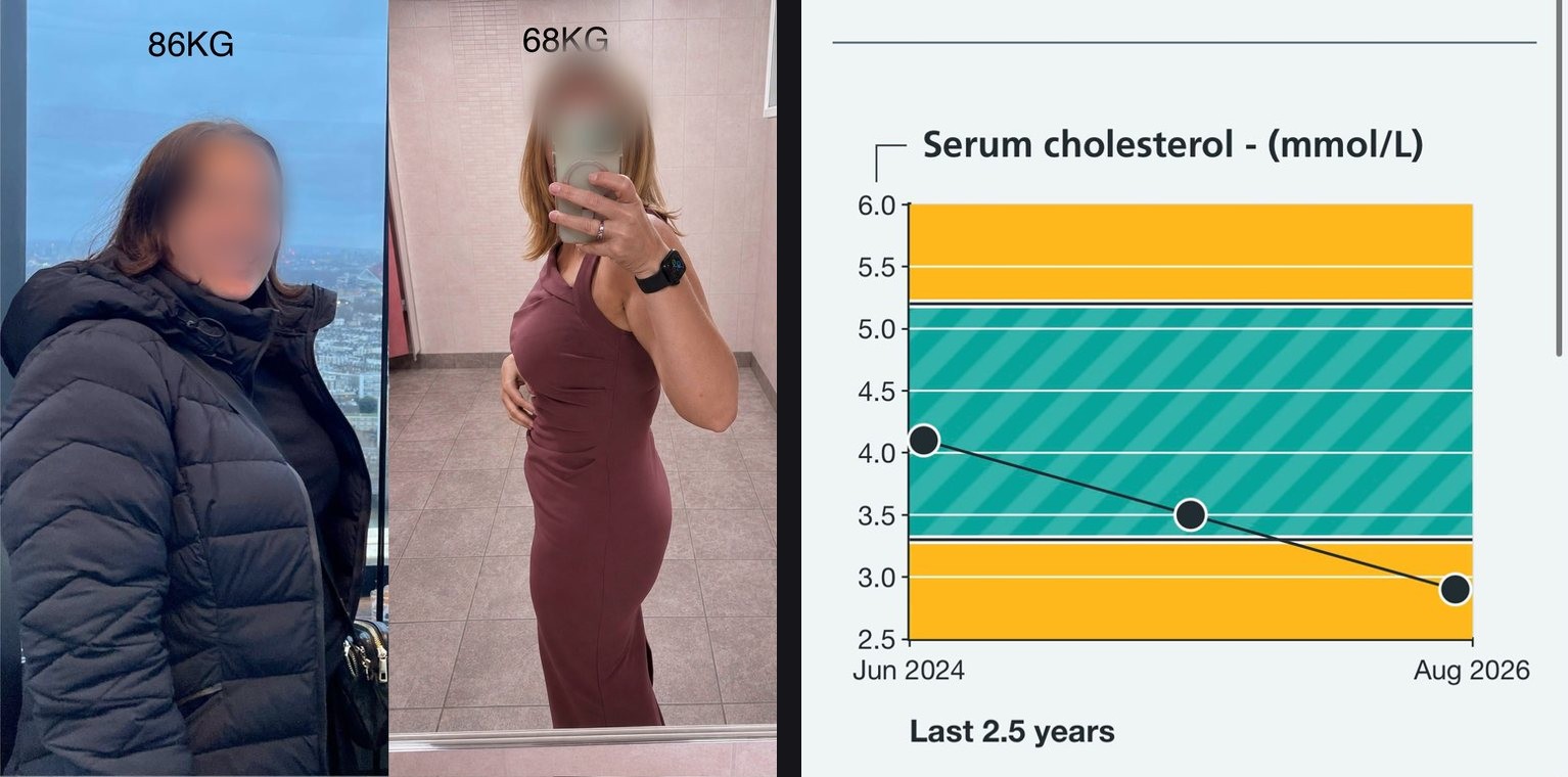 Anonymous client before and after, 86kg in a winter coat and 68kg in a fitted dress with faces blurred, beside her serum cholesterol chart falling from 4.1 to 2.9 mmol/L between June 2024 and August 2026